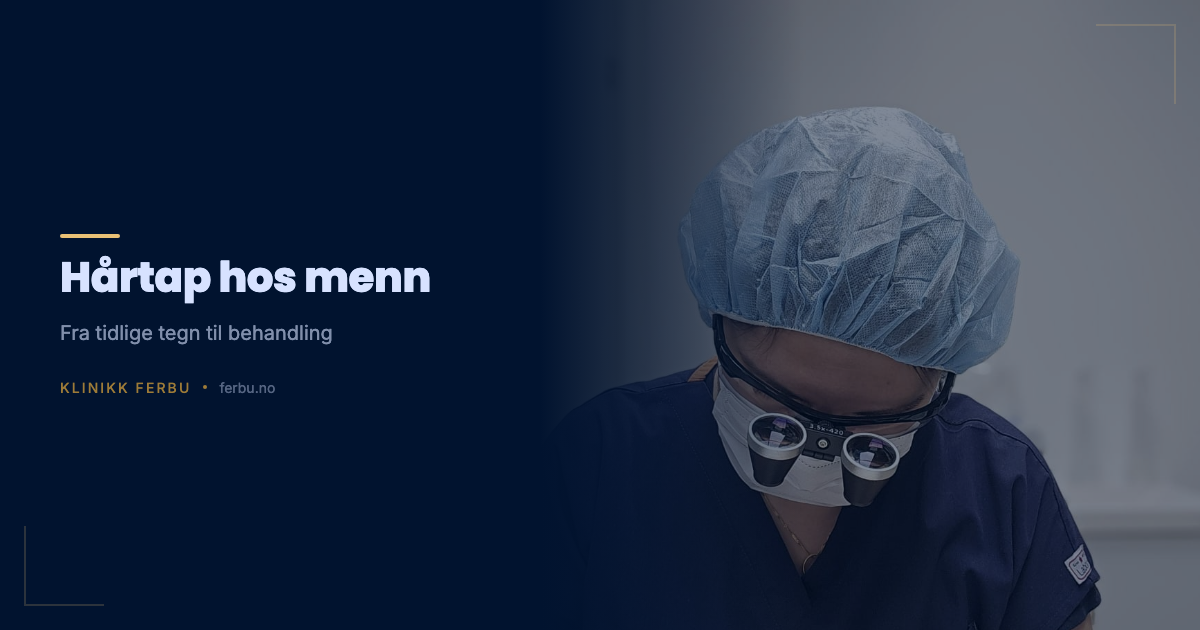 Hårtap hos menn: Årsaker, typer og moderne behandlingsmetoder